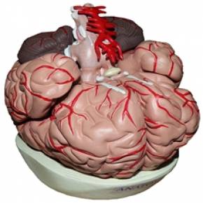 Cérebro Com Artérias Com 9 Partes