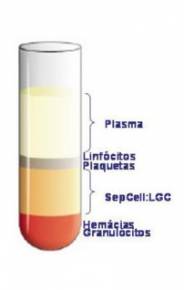 SepCell – Reagente Para Separação De Linfócitos
